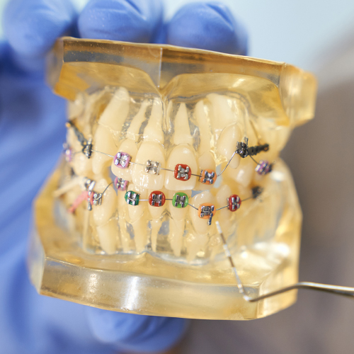 Orthodontist Port St. Lucie West